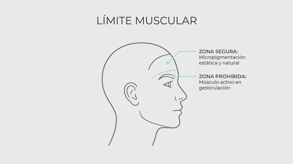 Esquema técnico que detalla la zona segura de micropigmentación capilar por encima del músculo dinámico.